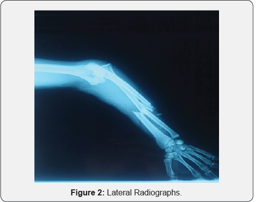 Click here to view Large Figure 2