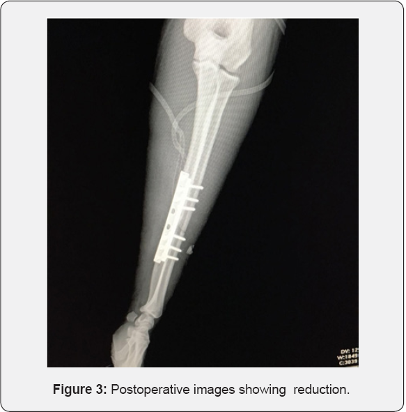 Click here to view Large Figure 3