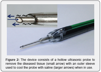 Click here to view Large Figure 2