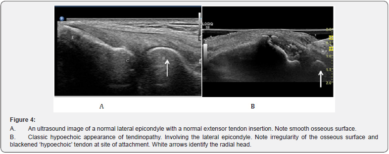 Click here to view Large Figure 4
