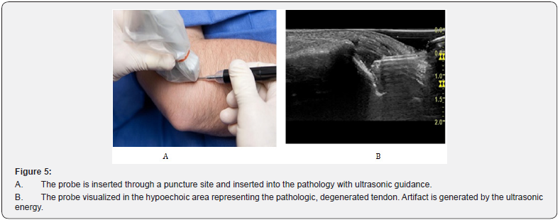 Click here to view Large Figure 5