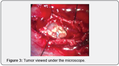 Click here to view Large Figure 3