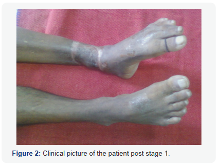 Click here to view Large Figure 2