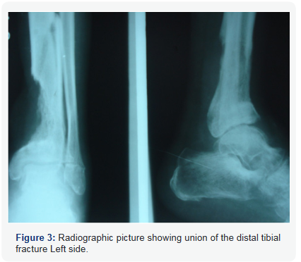 Click here to view Large Figure 3