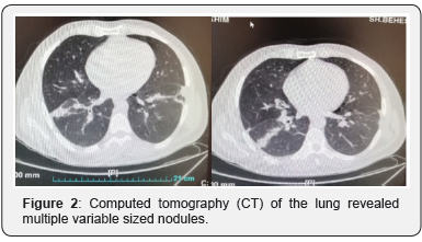 Click here to view Large Figure 2