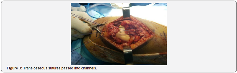 Click here to view Large Figure 3