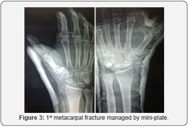 Click here to view Large Figure 3