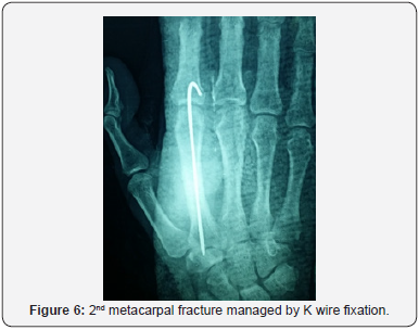 Click here to view Large Figure 6