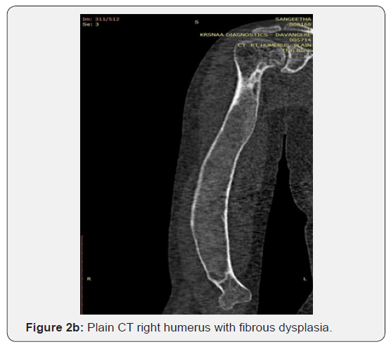 Click here to view Large Figure 2b