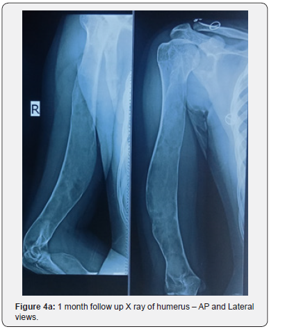 Click here to view Large Figure 4a