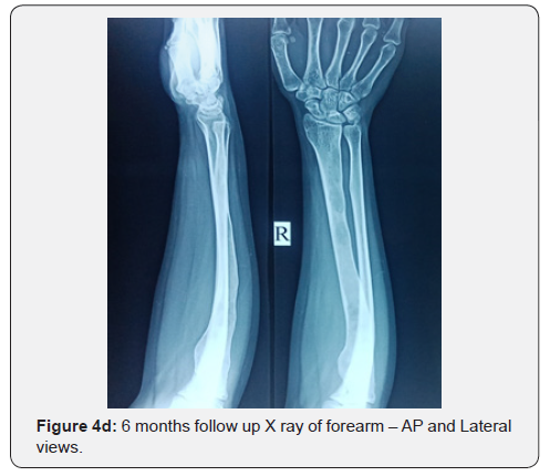 Click here to view Large Figure 4d