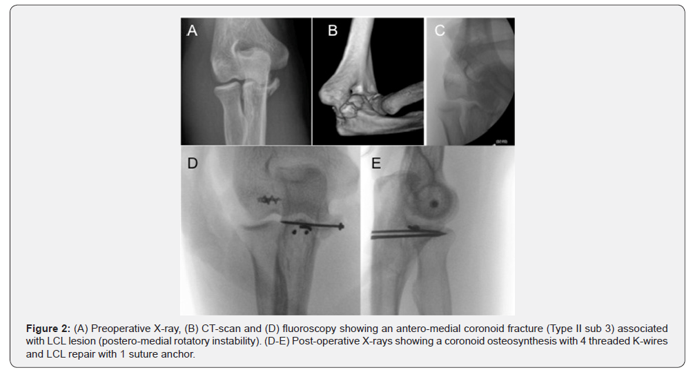 Click here to view Large Figure 2