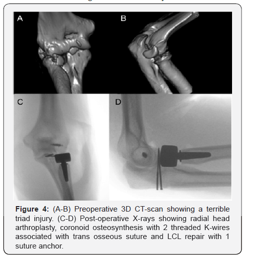 Click here to view Large Figure 4