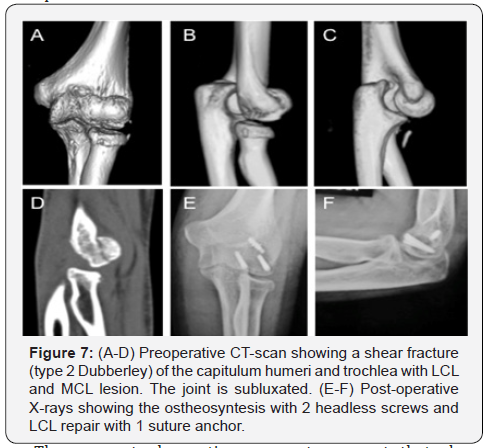 Click here to view Large Figure 7