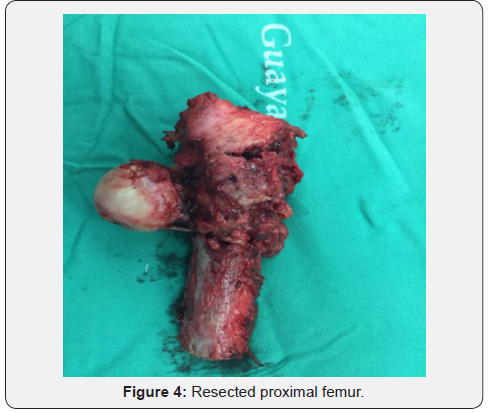 Click here to view Large Figure 4