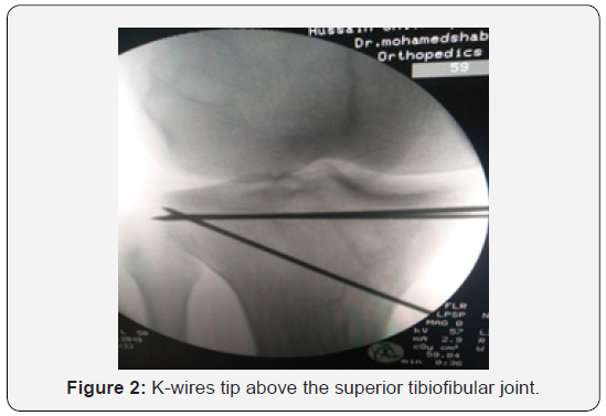 Click here to view Large Figure 2
