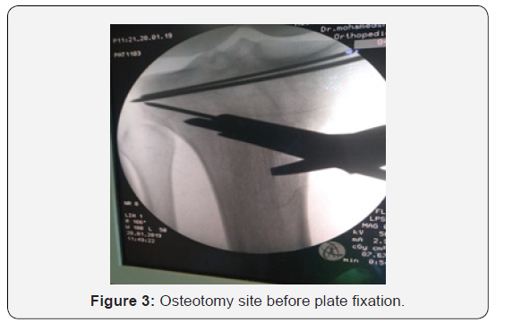 Click here to view Large Figure 3