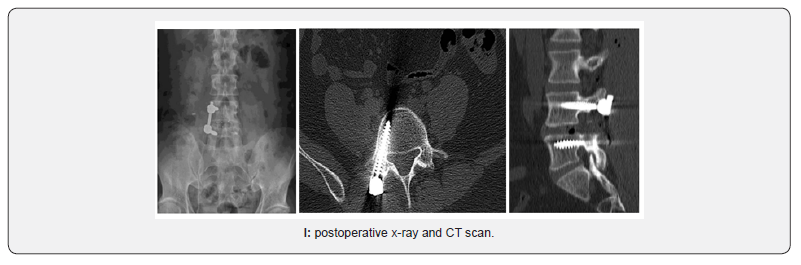 Click here to view Large Figure 1 Orthopedics and Rheumatology Open Access Journal