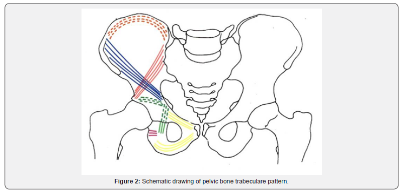 Click here to view Large Figure 2 Orthopedics and Rheumatology Open Access Journal