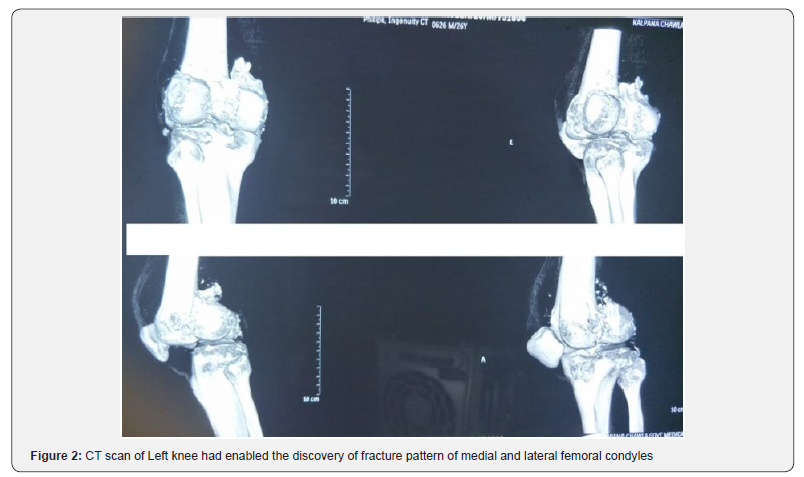 Click here to view Large Figure 2 Orthopedics and Rheumatology Open Access Journal