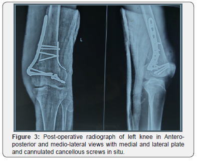 Click here to view Large Figure 3 Orthopedics and Rheumatology Open Access Journal