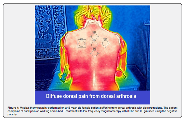 Click here to view Large Figure 4