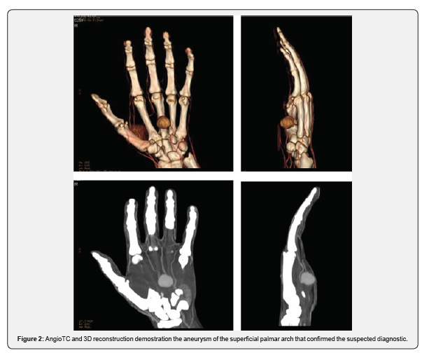 Click here to view Large Figure 2