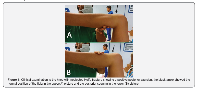 Click here to view Large Figure 1