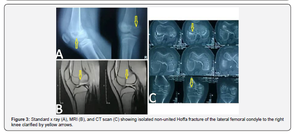 Click here to view Large Figure 2