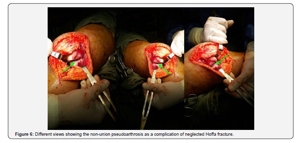 Click here to view Large Figure 6