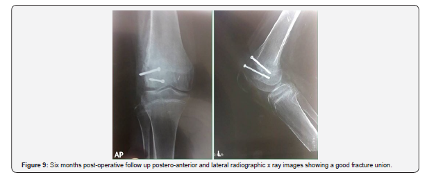 Click here to view Large Figure 9