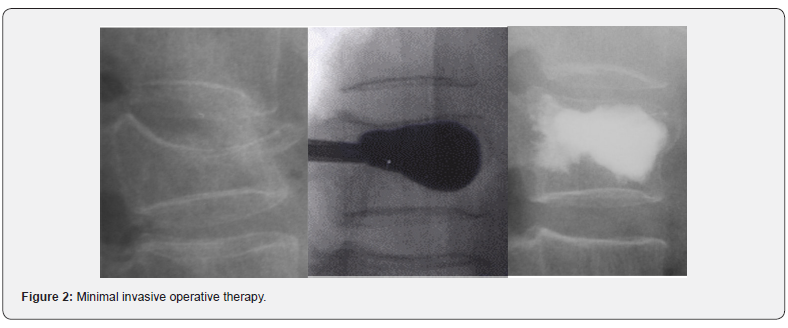 Click here to view Large Figure 2