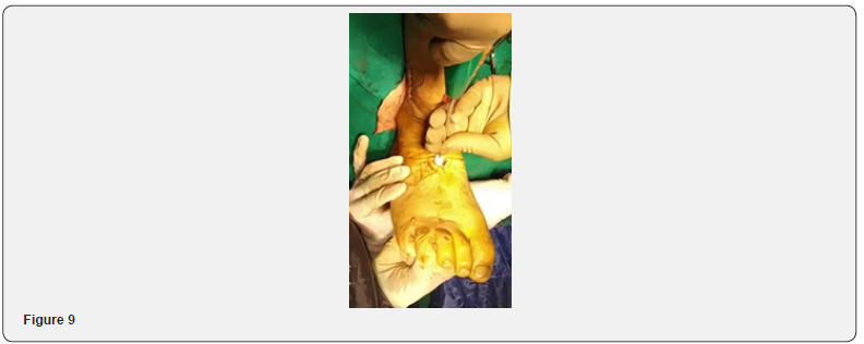 Click here to view Large Figure 9