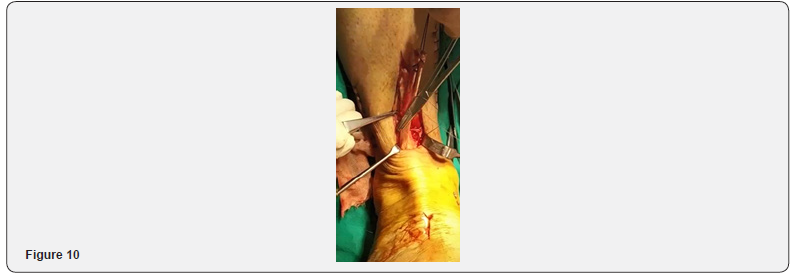 Click here to view Large Figure 10