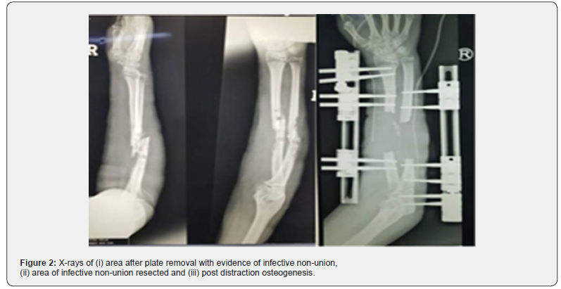 Click here to view Large Figure 2
