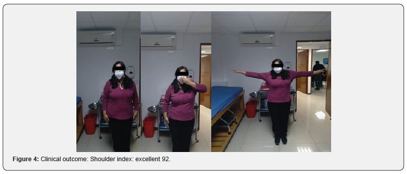 Click here to view Large Figure 4