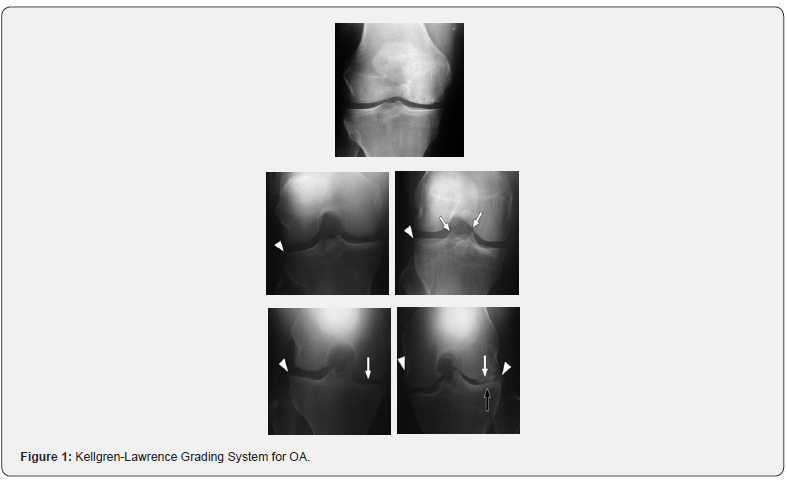 Click here to view Large Figure 1
