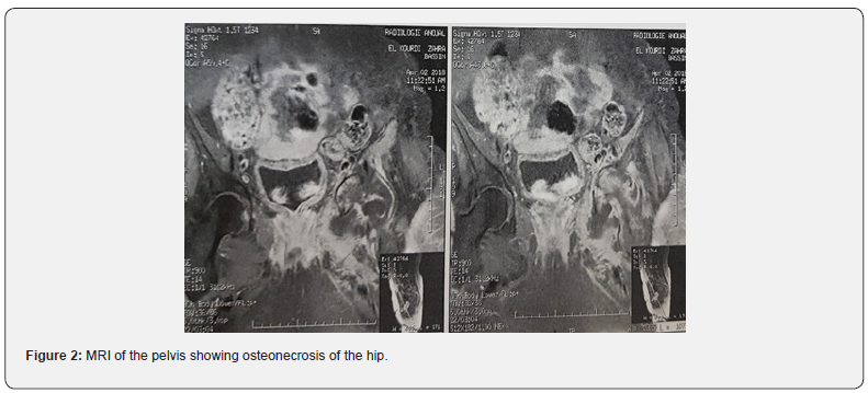 Click here to view Large Figure 2