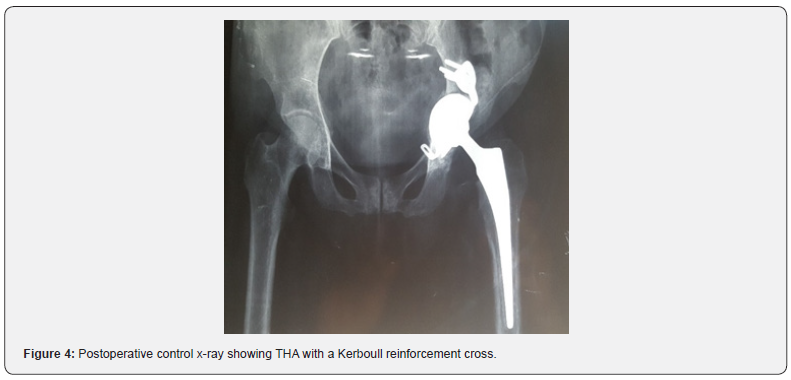 Click here to view Large Figure 4