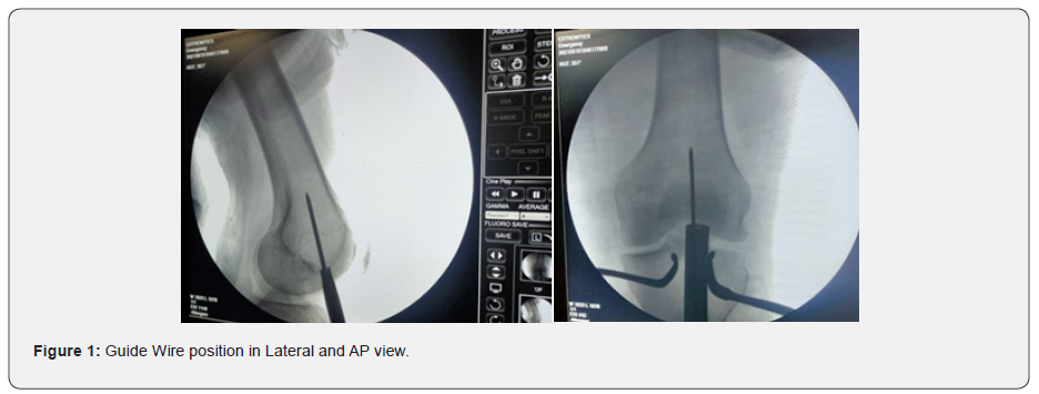 Click here to view Large Figure