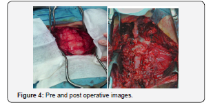 Click here to view Large Figure 4