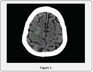 Click here to view Large Figure 1