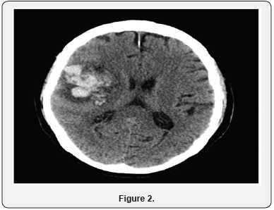 Click here to view Large Figure 2