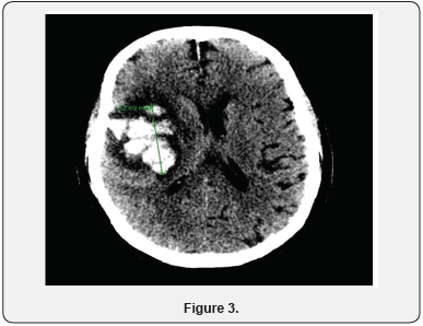 Click here to view Large Figure 3