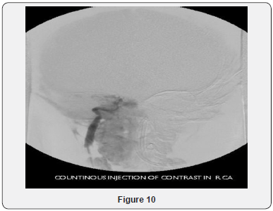 Click here to view Large Figure 10