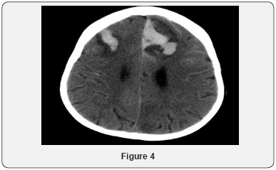 Click here to view Large Figure 4