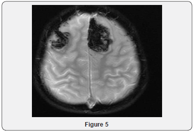 Click here to view Large Figure 5