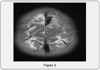 Click here to view Large Figure 6