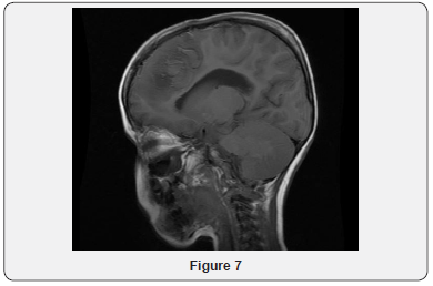 Click here to view Large Figure 7