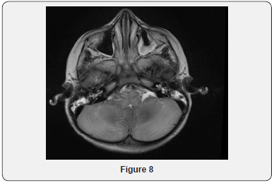 Click here to view Large Figure 8